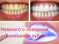 Немного о лазерном отбеливании зубов