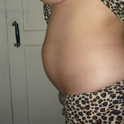 11 недель беременности фото живота