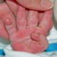 Почему у ребенка облазит кожа на пальцах рук