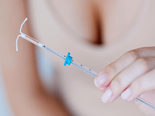 Внутриматочная спираль: чем хорош и чем плох этот метод контрацепции?