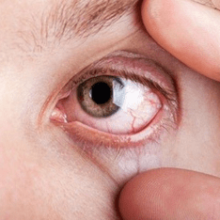 Воспалился глаз у ребенка — как и чем лечить?