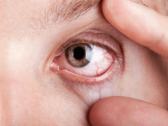 Воспалился глаз у ребенка — как и чем лечить?