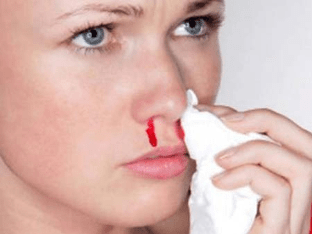 Что делать, если часто течет кровь из носа при беременности?