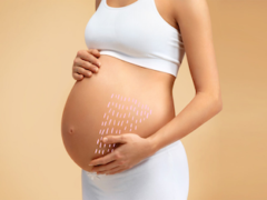 Что нужно делать, чтобы не было растяжек во время беременности?