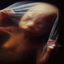 18 неделя беременности: ребенок и ощущения женщины